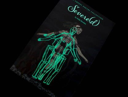 Severe(d) by Holly Riordan